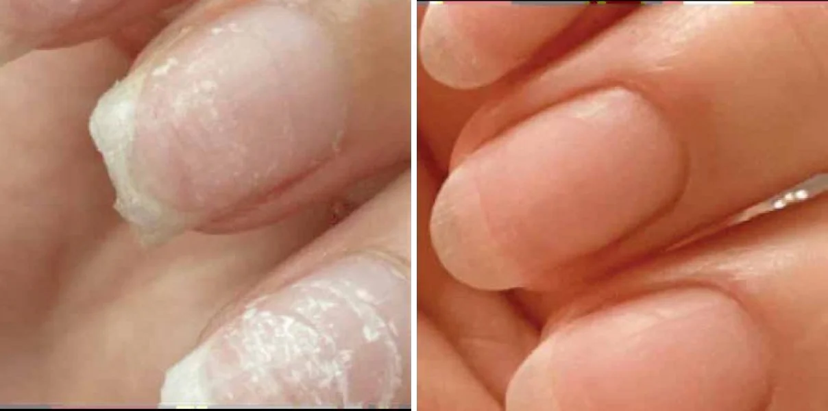 Close view of a woman's nails before and after 8 weeks of liquid marine collagen